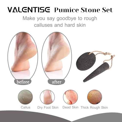 Pumice Stone Set - 2 Packs Natural Foot Scrubbers to Remove Dead Skin and Callusess, Pedicure Exfoliation Tools for Feet and Hands