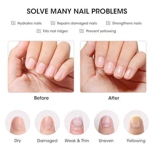 GELLEN Clear Nail Polish Ridge Filling Base Coat, Nail Strengthener and Growth, Ridge Filler For Nails, Hydrate Strengthen Nourish Damaged Dry Natural Nails, Shea Butter & Vitamin E & Protein Formula