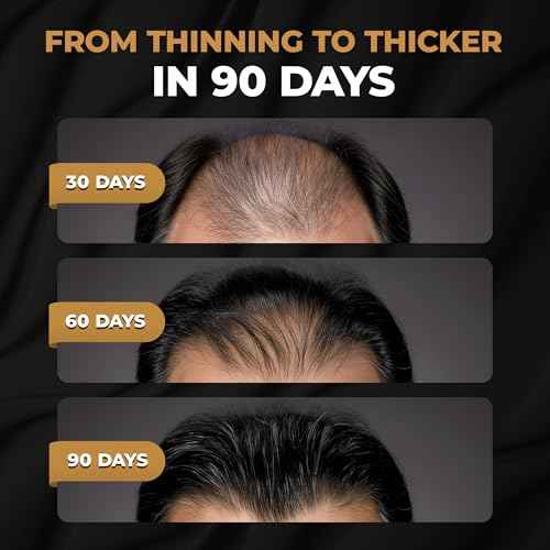 SPARTAN¢â Root Activator Shampoo For Men - Hair Growth Shampoo for Hair Loss and Thinning Hair