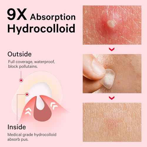 Sosky Pimple Patches for Face, FSA HSA Eligible Invisible Hydrocolloid Acne Patches, Zit Sticker for Face and Skin, Pimple Patches for Covering Zits, Blemishes with Salicylic Acid 120 Count