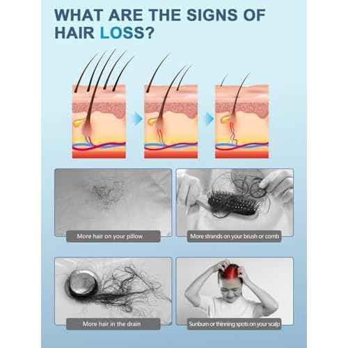 Anyash 5% Minoxidil Hair Growth Oil For Men and Women, Biotin Infused Serum For Hair Regrowth and Thinning, Natural Treatment for Thicker, Longer, Fuller, Healthier Hair, 60ml