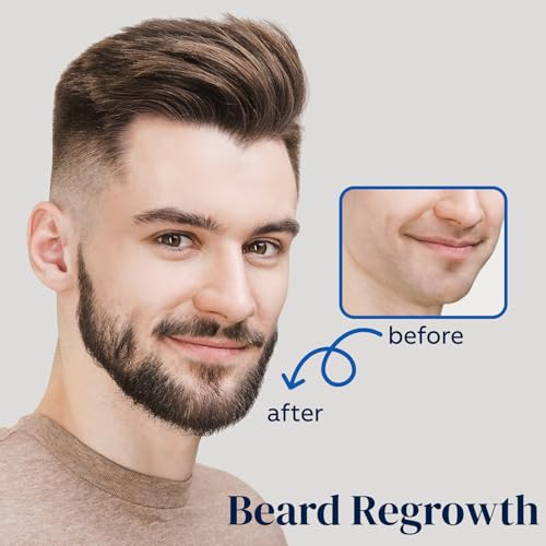 5% Minoxidil for Men Hair, Minoxidil for Women Hair Growth, Minoxidil Hair Growth Spray 2PCS.