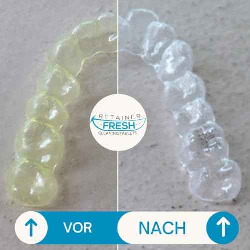 Retainer Cleaner Tablets - 120 Tablets 4 Month Retainer Fresh - Retainer Cleaning Tablets, Mouth Guard Cleaner, Denture Cleaner, Aligner Cleaner, Brite Retainer Tablets