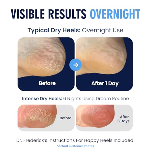 Dr. Frederick's Original Moisturizing Heel Socks for Dry Cracked Heels Treatment - Infused with Olive Oil, Jojoba Oil and Vitamin E - 2 Pairs - Stocking Stuffers for Adults - Original Formula