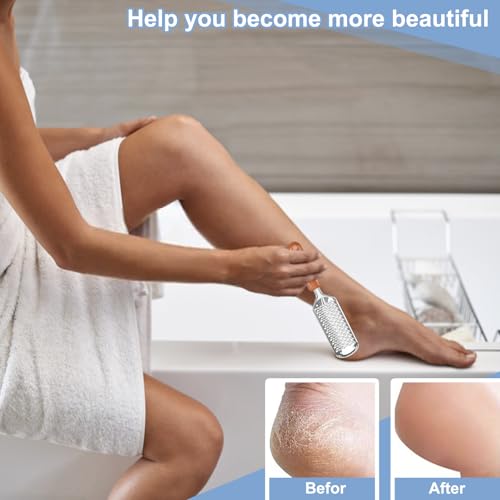 Professional Foot Scrubber Dead Skin Remover, Pedicure Foot File Callus Removal, Heel Scraper for Cracked Heels, Microplane Cheese Grater for Feet, Foot Rasp for Hard Skin(T1)