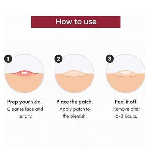 MUVEX Acne Patches for Pimples ? Hydrocolloid Pimple Patch for Whiteheads ? Overnight Spot Treatment ? Oil Absorbing, Drug-Free, Invisible, Vegan & Safe for Sensitive Skin ? 72 Count.