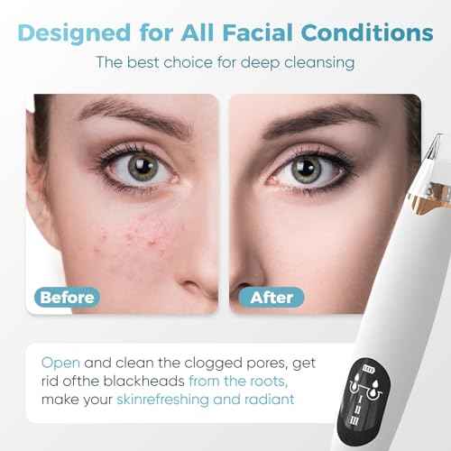 Facial Pore Blackhead Remover Vacuum - Facial Pore Cleaner with 3 Adjustable Suction Levels, 3 Probes, USB Charging Interface - Blackhead Extractor Tools for Women & Men (Gold)