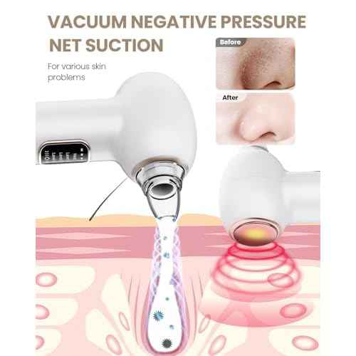 Pore Vacuum Blackhead Remover Kit - 5 Suction Heads & Extractor Tools, 3 Adjustable Suction Levels - Facial Pore Cleansing for Women&Men (White)