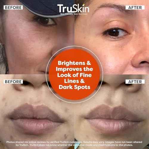 TruSkin Vitamin C Serum For Face ? Anti Aging Face Serum with Vitamin C, Hyaluronic Acid, Vitamin E ? Brightening Formula ? Improve Appearance of Dark Spots, Tone, Fine Lines & Wrinkles, 1 Fl Oz