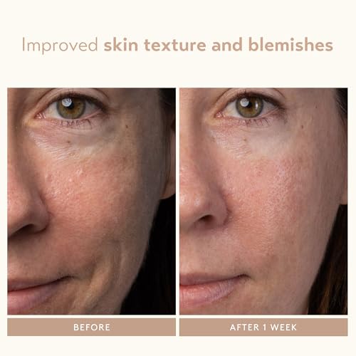 SHANI DARDEN SKIN CARE Lactic Acid Face Serum, Active Night Serum to Help with the Look of Radiant and Smooth Skin, Gentle But Powerful Face Exfoliator, 1.01 fl oz