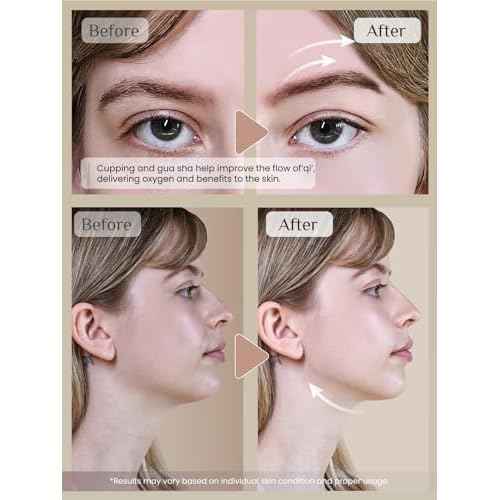 Rena Chris Facial Cupping Set & Gua Sha Facial Tool - Silicone Cupping Set & Rose Quartz Gua Sha Stone - Face Cupping Therapy Set for Natural Skin Care, Puffiness, Lip Plumping(Pink)