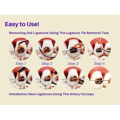 ARTMAN INSTRUMENTS Dental Braces Color Changing Kit, Orthodontic Ties Changing kit, Change The Color of Your Braces Yourself in Minutes Ligas para Brackets Ortodoncia