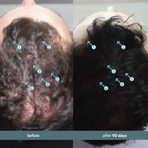 DS Labs Spectral Booster (formerly Spectral.F7) Hair Density Serum, 60mL - Non-Greasy, Leave-In, Supports Fuller, Thicker, Looking Hair, with Astressin-B Peptide & Copper Peptides, Water-Based