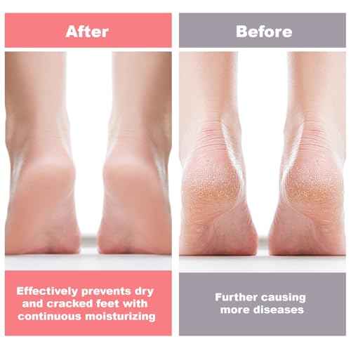 6 Pairs Silicone Socks for Dry Cracked Feet Women,New Upgrade Thickened Moisturizing Foot Mask Exfoliating Silicone Socks,Spa Gel Moisturizer Socks Foot Care After Pedicure