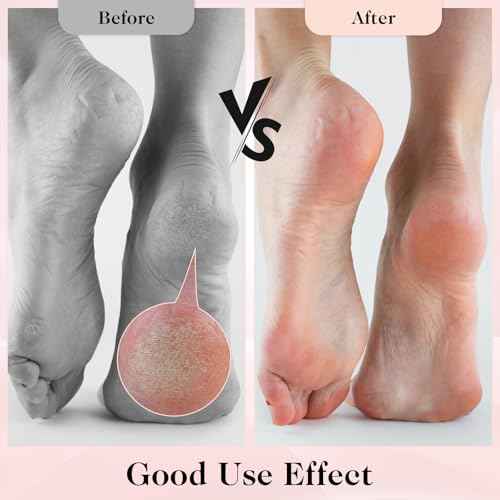 3 Pairs Aloe Infused Socks Lotion Socks Moisturizing Spa Socks Non Slip Coral Fleece Socks for Repairing Softening Dry Cracked Feet Infused Gel Sleeping