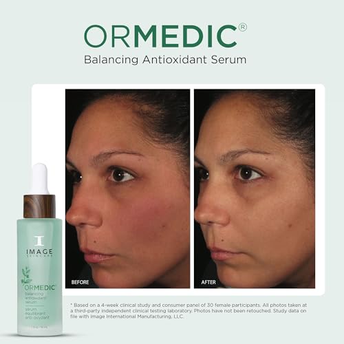 IMAGE Skincare, ORMEDIC Balancing Antioxidant Serum, Hydrates & Soothes Skin with Organic Aloe Vera, Vitamin C, & Botanical Extracts, 1 fl oz