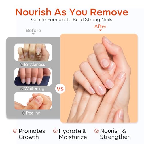 Modelones Semi-Cured Gel Nail Strip Remover | Nail Glue Remover Easy Peel Gel Strips, Press on Nails and Nail Polish | Gentle, Non-Drying, Nourishing and Hypoallergenic Acetone-Free Formula 50ML