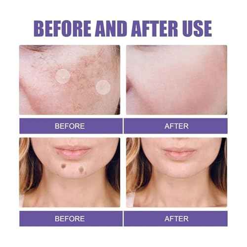 for Dark Spots from Cosmetics