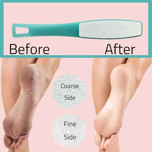 1 ALAZCO Double Sided Foot File Pumice Ergonomic Handle Scrubber Immediate Result Smooth Feet Heel Scraper Exfoliate Buffer Dead Skin Callus Corn Emery Fine & Coarse Pedicure Tool