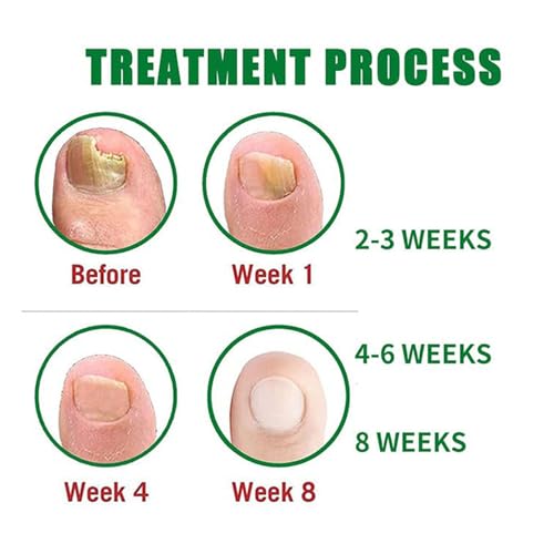 Natural Nail Treatment Gel, Nail Growth Serum for Repair & Strengthener (2)