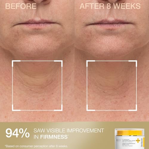 StriVectin Tighten and Lift Advanced Neck Cream PLUS with Alpha-3 Peptides for Neck and D?collet?, Smoothing Look of Wrinkles and Fine Lines, Improves Crepey Skin and Vertical Lines