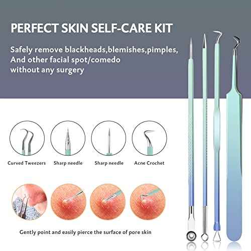 Blackhead Remover Tools MENOLY 10Pcs Pimple Popper Tool Kit, Blackhead Remover Extractor Tools, Acne Kit for Blackhead,Blemish,Zit Whitehead and Comedone Extractor Tool with Leather Bag