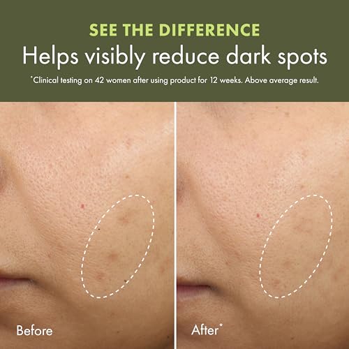 Origins Mega-Mushroom Dark Spot Cream | Reduces Visible Hyperpigmentation & Post-Acne Marks | With Vitamin C & Reishi Mushroom, 1.7 Fl Oz