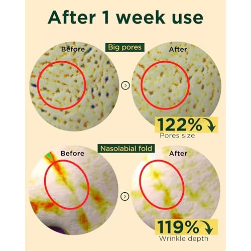 EASYDEW DW-EGF Peptide Retinol 0.03% Cream ? Beginner Retinol Night Cream for Hypoallergenic Skin Care - Firm Skin, Wrinkle Improvement - Korean Daily Anti Aging Face & Neck Treatment, 1.01fl. oz.