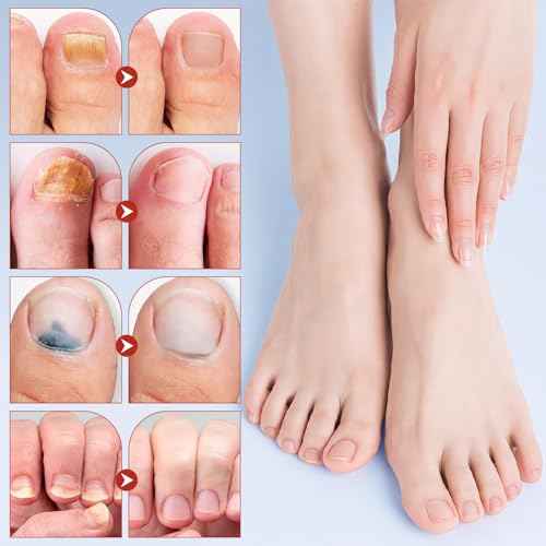 Nail Patches, 8-Hour Overnight Treatment, Fast-Acting Toenail Repair Patches, 21 Patch,for Damaged Nails Foot Nails Repair and Care,Strengthens Brittle Nail