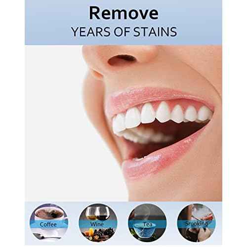 MySmile Teeth Whitening Gel Pen Refill Pack, 3 Non-Sensitive Teeth Whitening Pen, Deluxe Teeth Whitener Dental Grade Tooth Whitening Gel with Carbamide Peroxide for Home, 10 min Fast Result