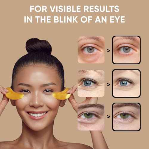 Under Eye Patches (20 Pairs) - Eye Patches For Puffy Eyes And Dark Circles - Under Eye Mask For Beauty & Personal Care - Under Eye Mask Amino Acid & Collagen For Dark Circles And Puffiness by Celor