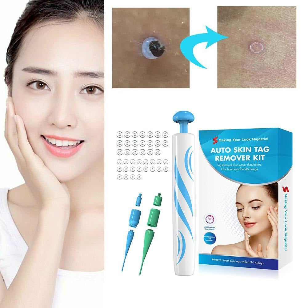 Painless Skin Tag Remover Facial Beauty Tool for Mole Wart Removal - Blue
