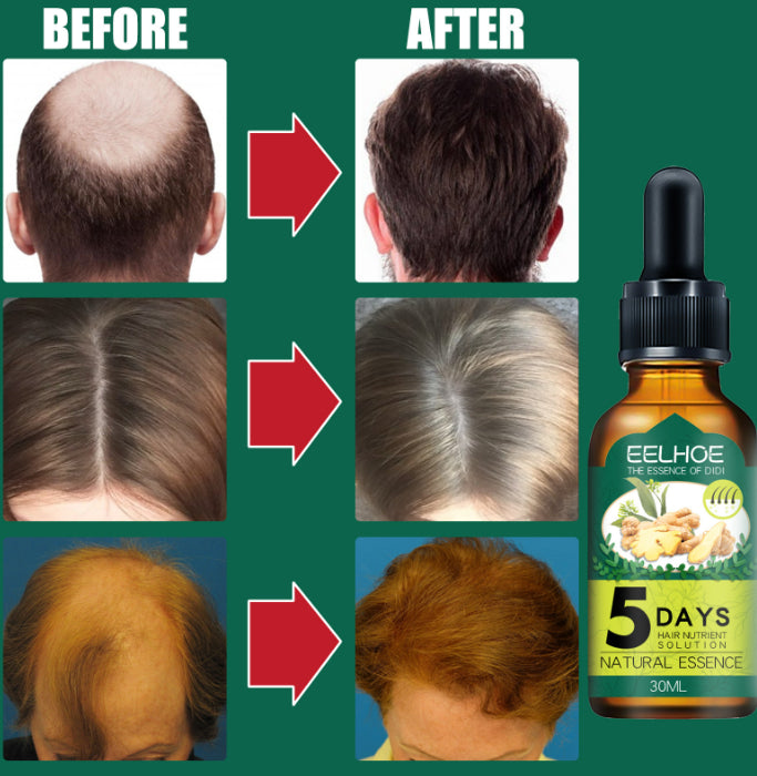 Ginger Hair Care Essential Oil - 30ml