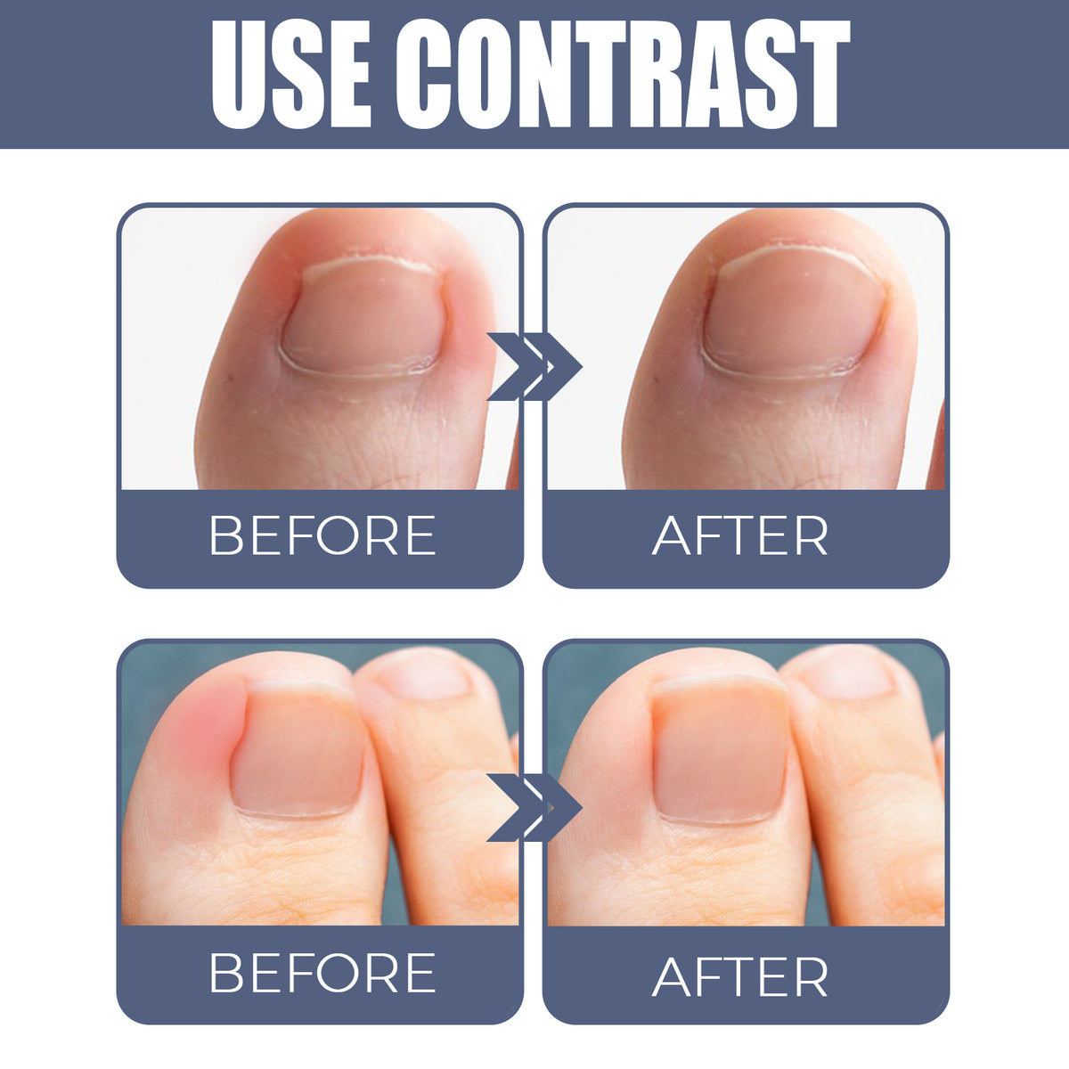 Nail Care Oil 10ml - Toenail & Cuticle Treatment