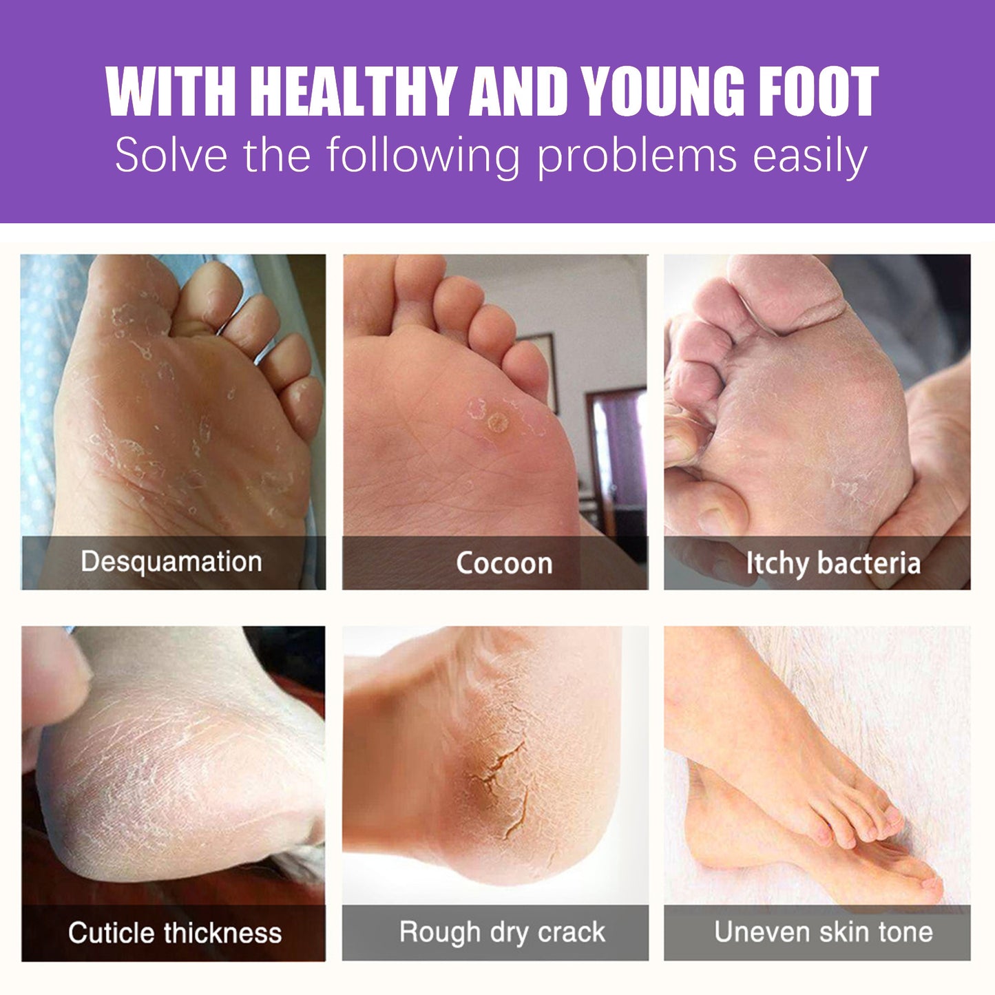 Ginger Foot Mask for Exfoliating and Moisturizing Dry Cracked Skin