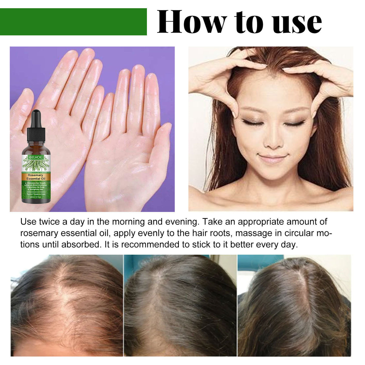 Rosemary Hair Growth Oil - Anti-Hair Loss Essential Oil 30ml