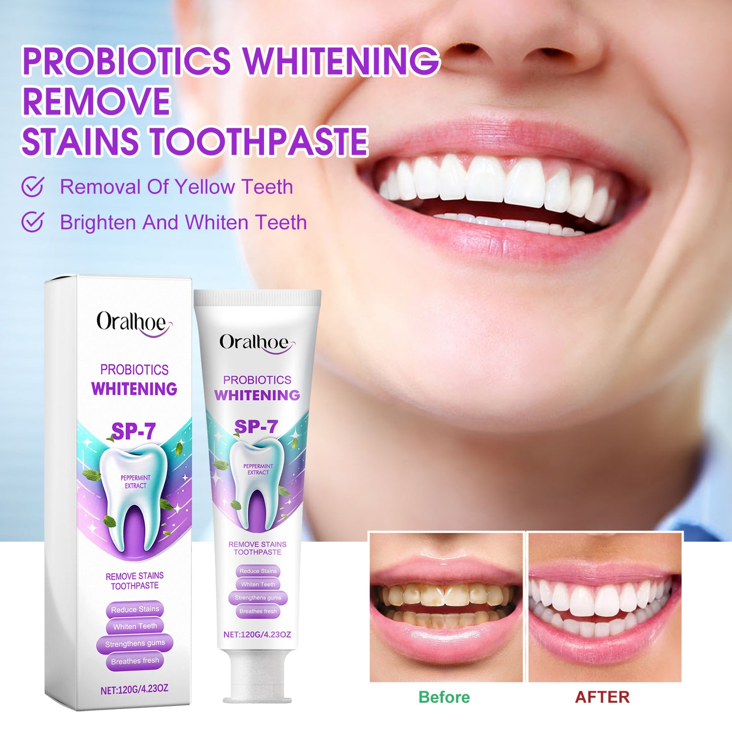 Probiotic Whitening Toothpaste 120g - Dental Care for Stain Removal & Fresh Breath