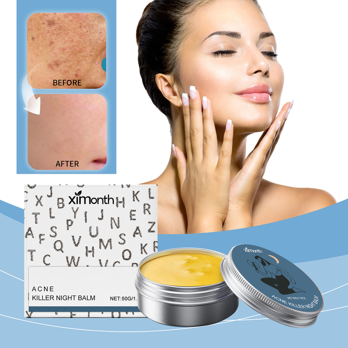 Moisturizing Acne Cream 50g - Gentle Skin Care for All Skin Types