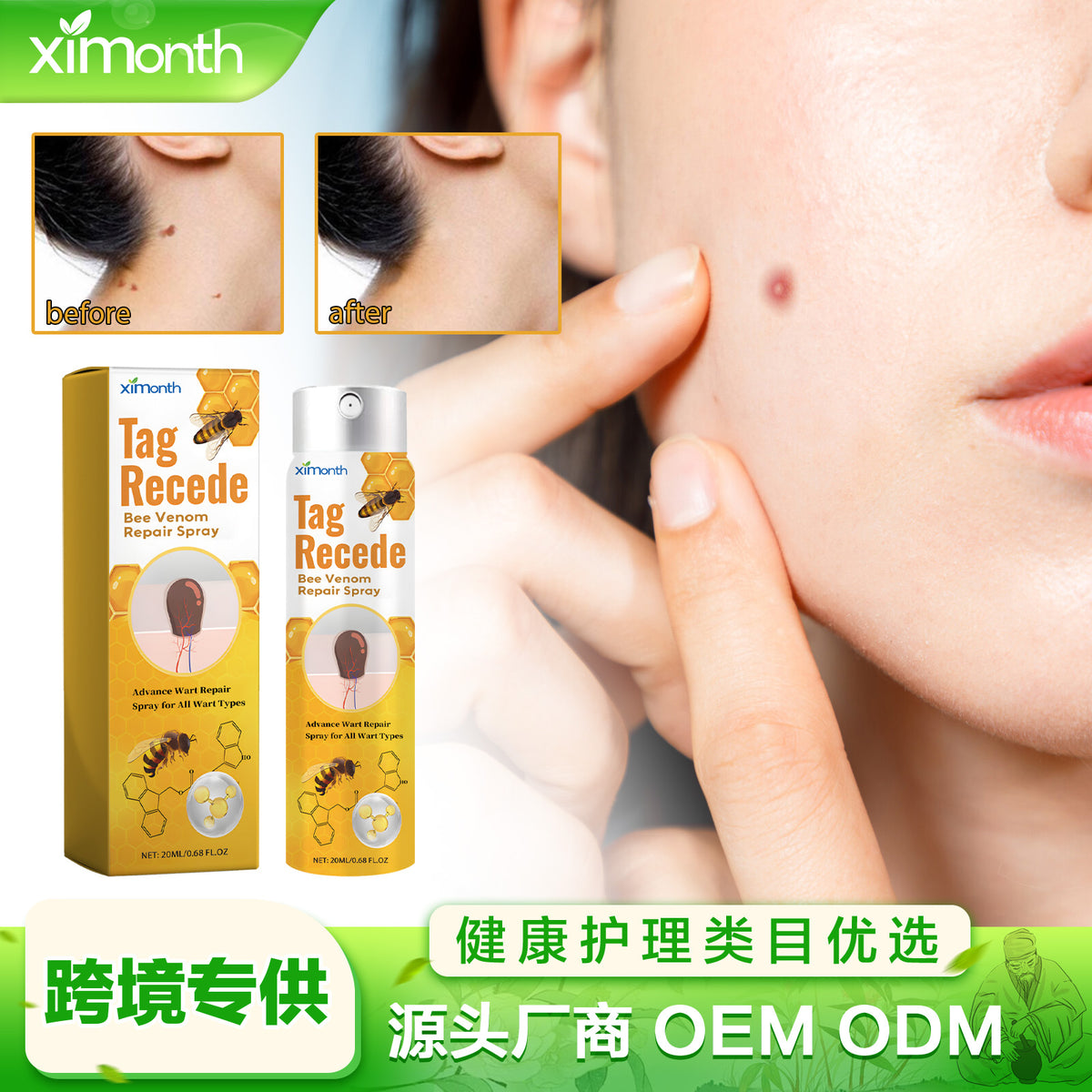 Bee Venom Cleansing Spray for Warts, Spots & Moles