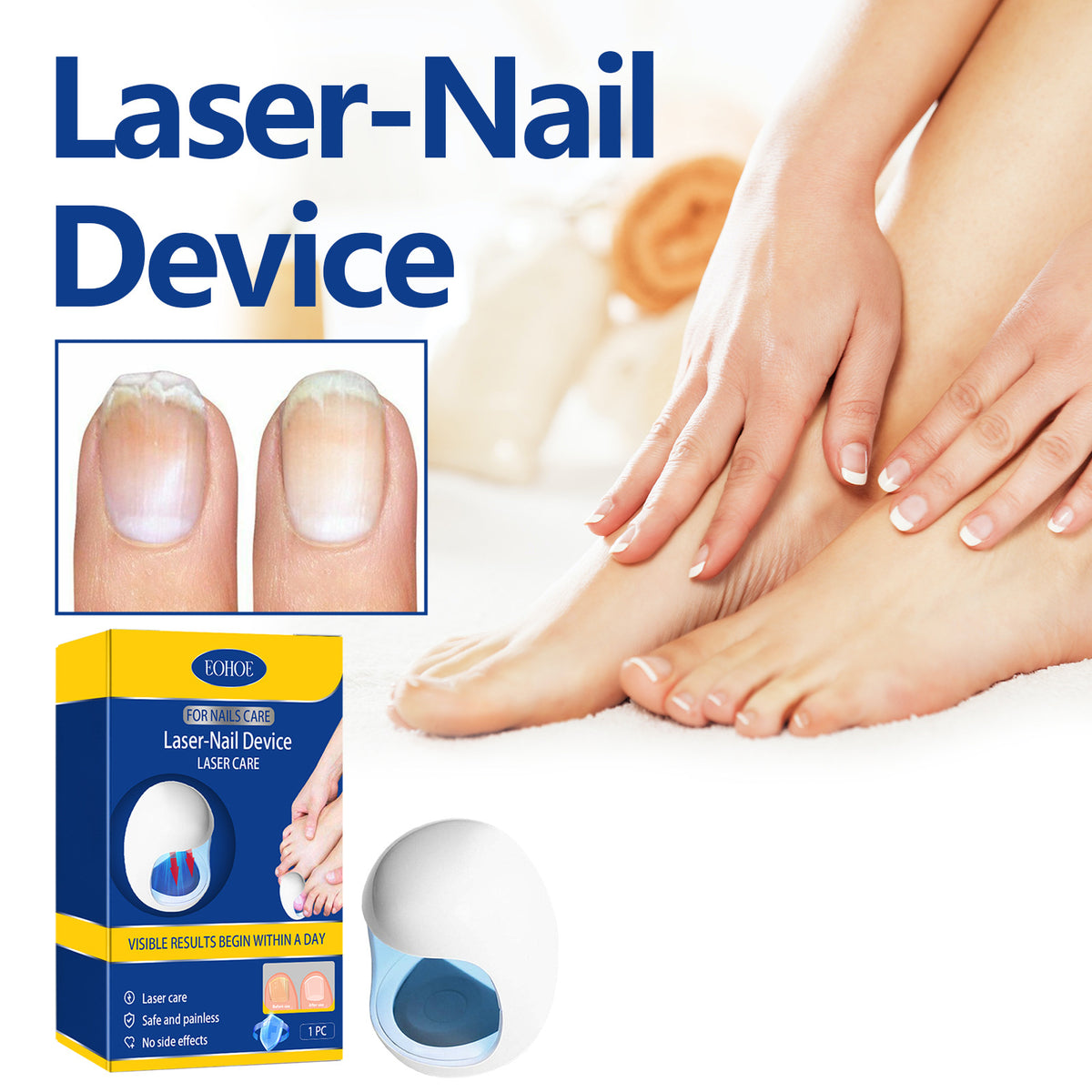 Nail Care Phototherapy Device for Soft Nail Repair - 1 Piece