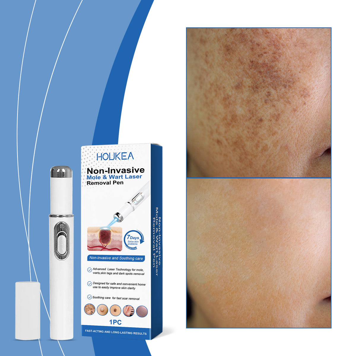 Skin Care Laser Pen - Portable Body Care Device for Home Use