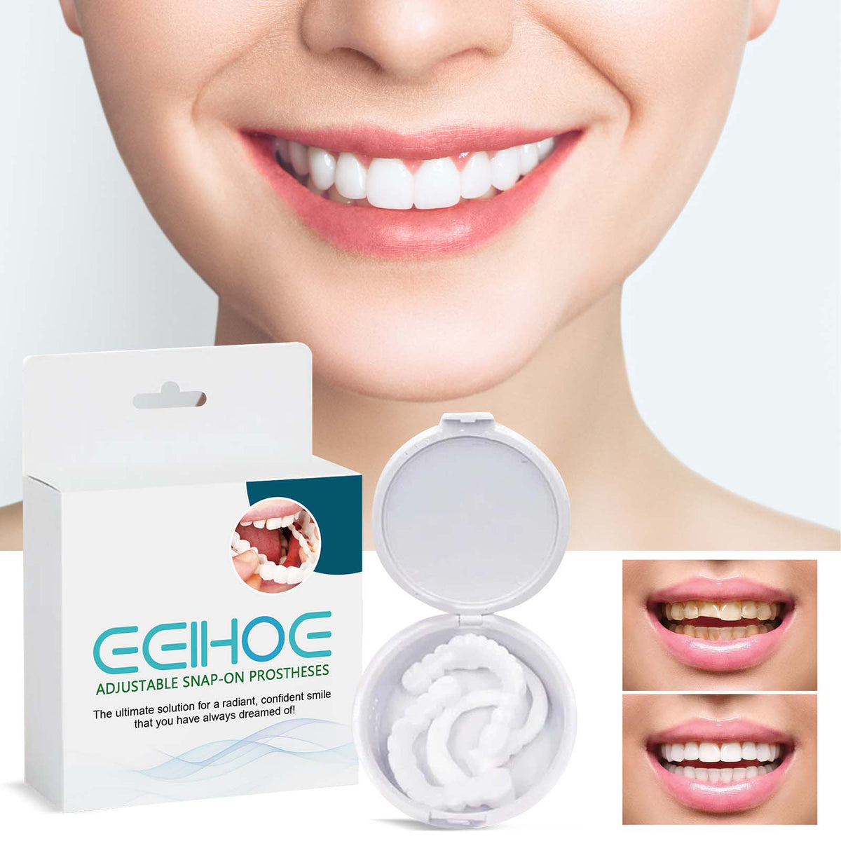 Adjustable Snap-On False Teeth - Resin Veneers