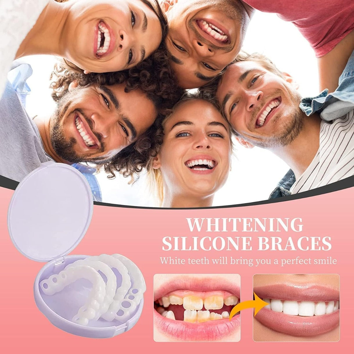 Comfortable Silicone Cosmetic Veneers for Dentures - White