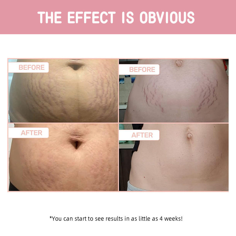 Tightening Cream Moisturizing Lifting Light Lines Firming Skin Body