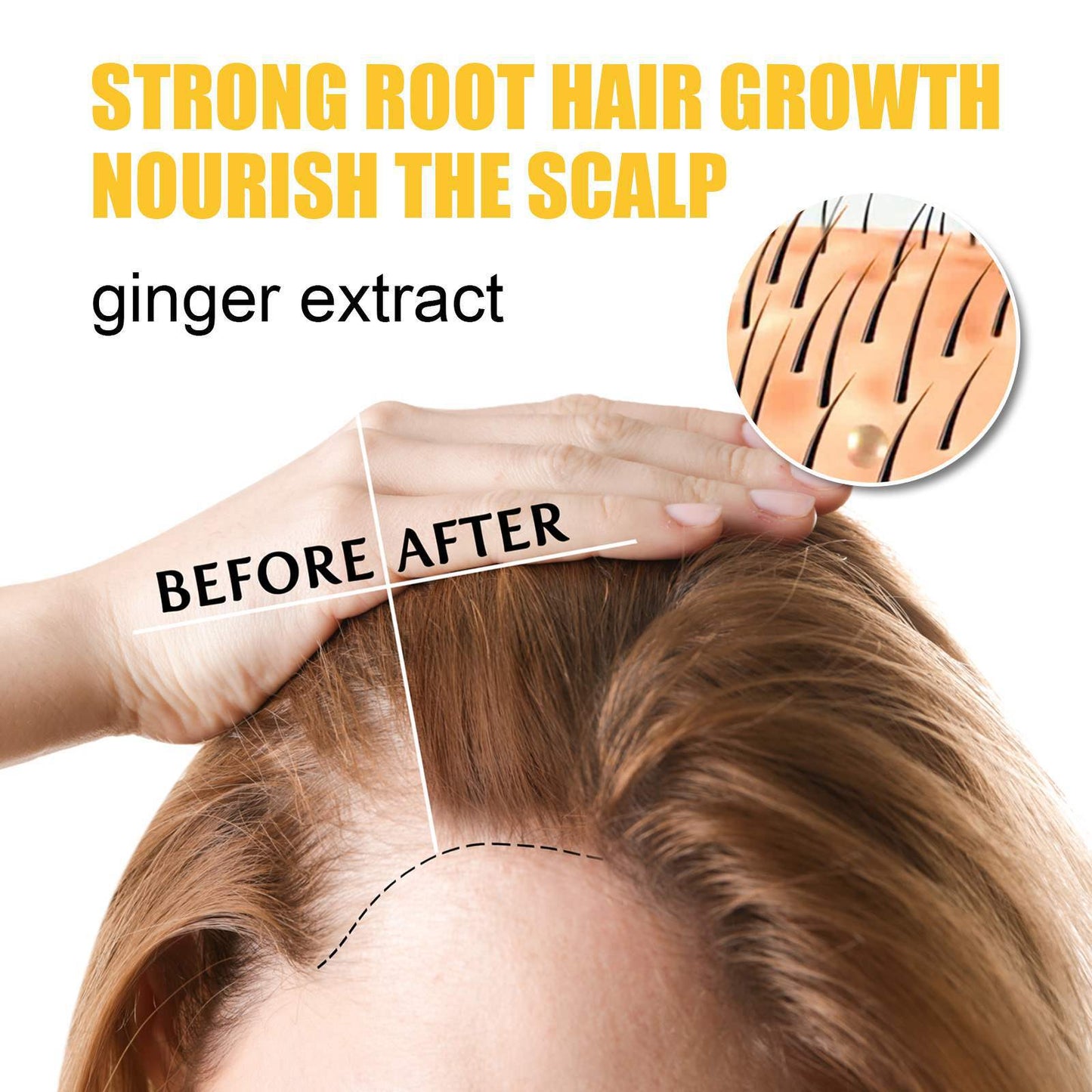 Ginger Hair Moisturizing Pomade - Anti-Itching & Dandruff Treatment 30g