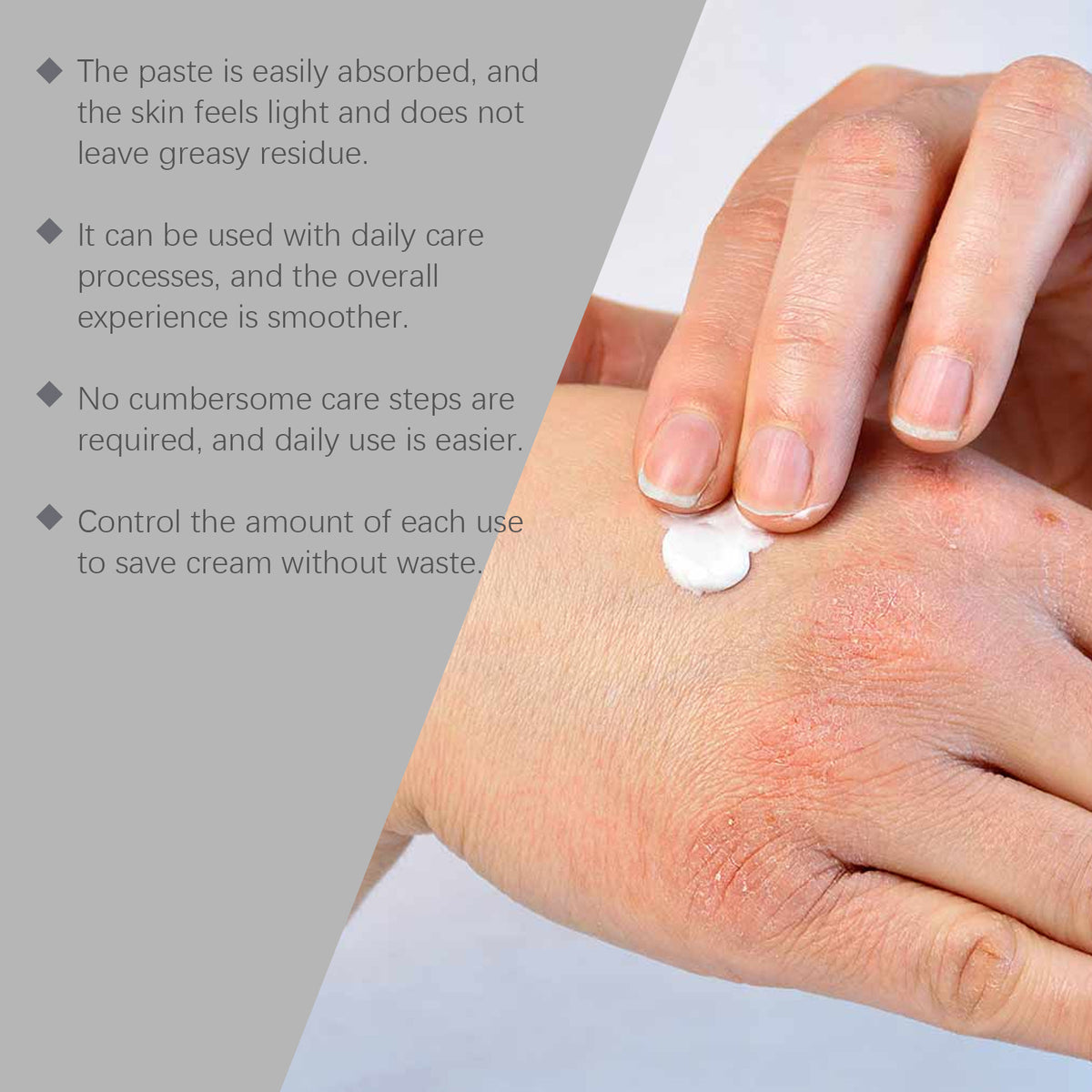 Skin Neck Cream Gentle And Soothing