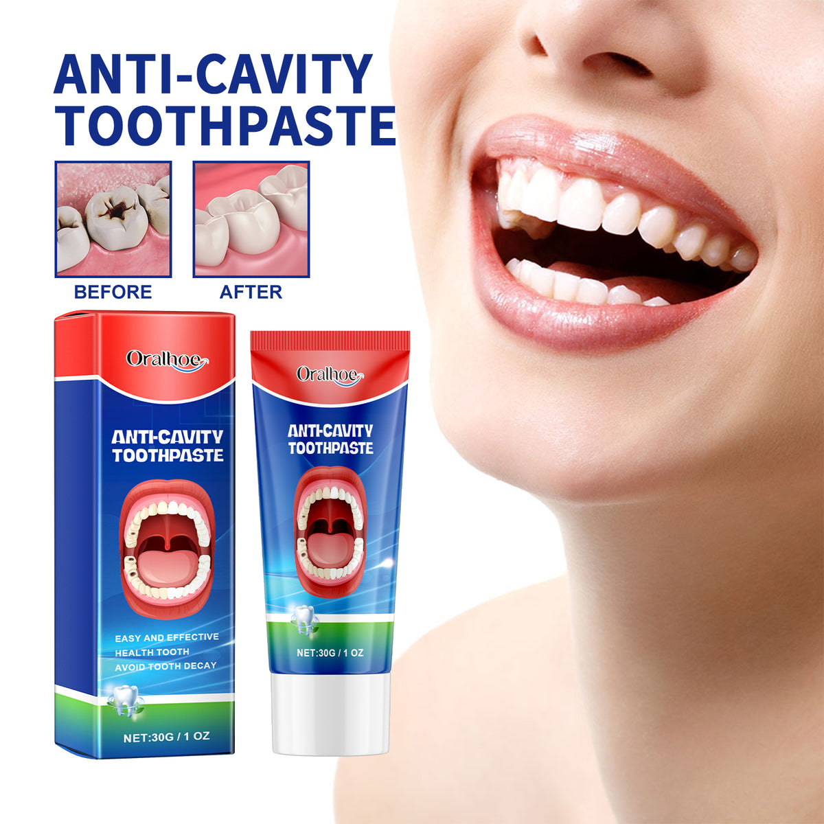 Anti Cavity Toothpaste 30g