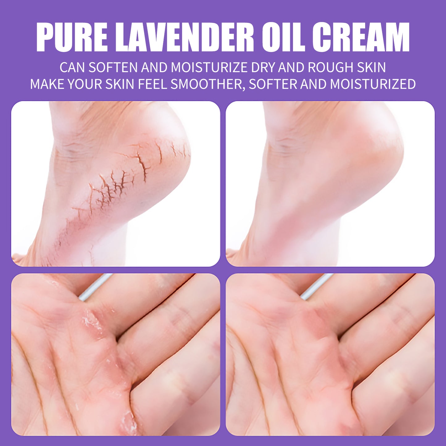 Lavender Oil Foot Cream - Deep Hydrating & Anti-Cracking Moisturizer