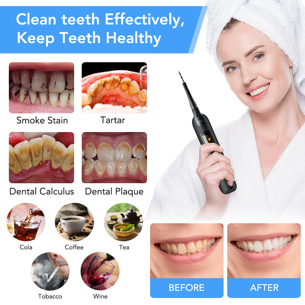 Portable Electric Dental Scaler for Oral Care - USB Rechargeable, Waterproof, LCD Display