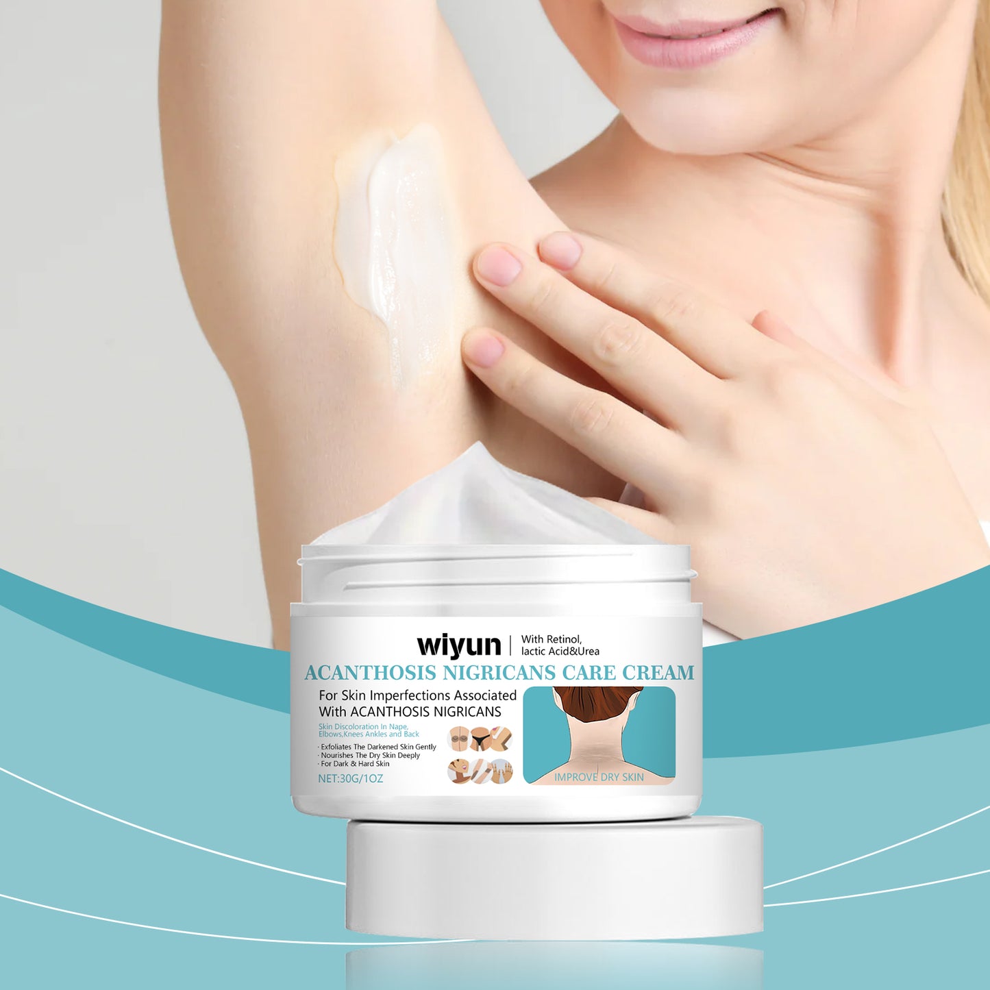 Acanthoderma Nigricans Care Cream - Hydrating Dark Spot Corrector